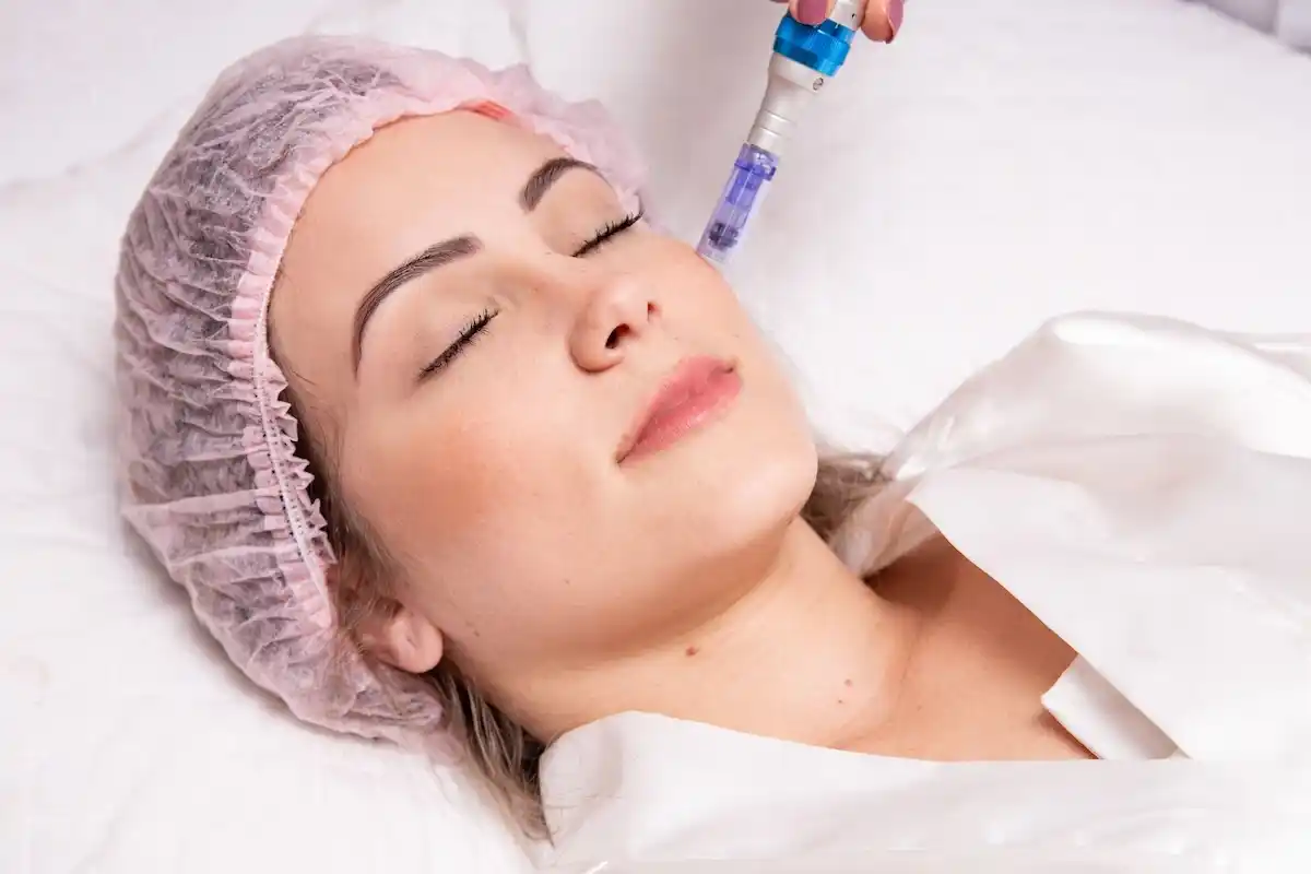 SkinpenMicroneedling-img