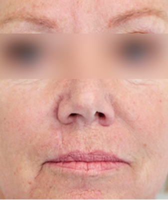 Halo® - After Image