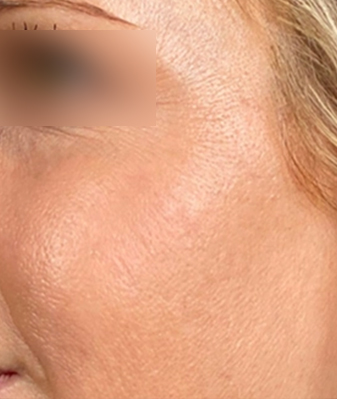 Halo® - After Image
