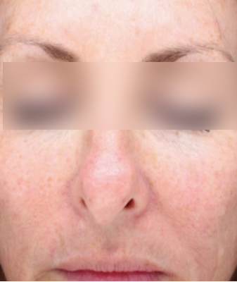 Halo™ - After Image