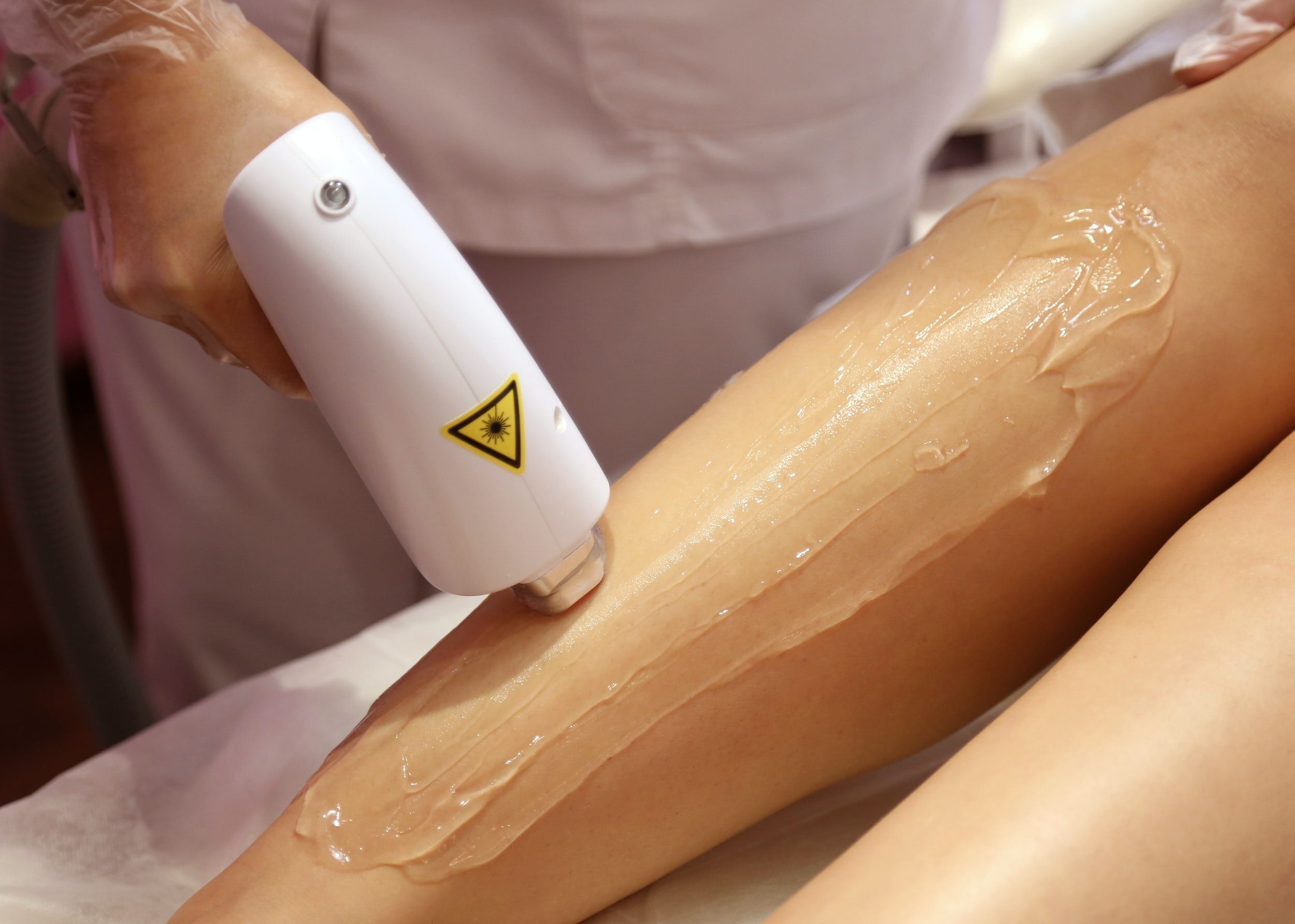 laserHairRemoval