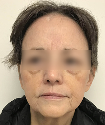 Agnes™ - After Image