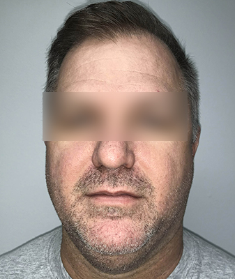 Agnes™ - After Image