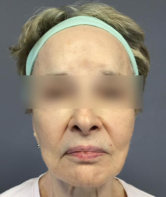 Agnes™ - After Image