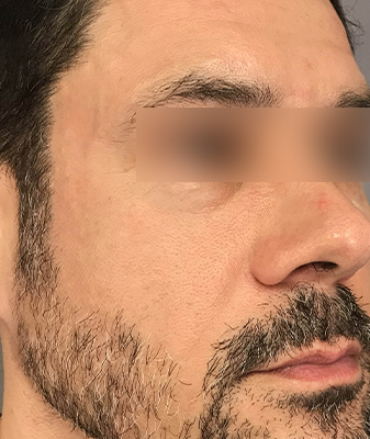 Halo™ - After Image