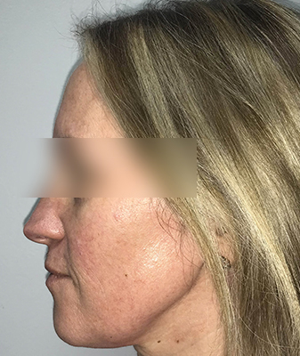 Scarlet ™ - After Image