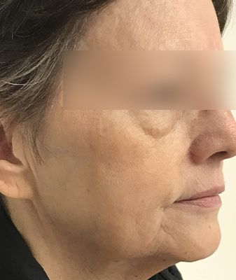 Scarlet ™ - After Image