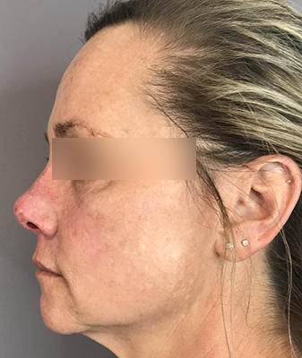 Scarlet ™ - After Image